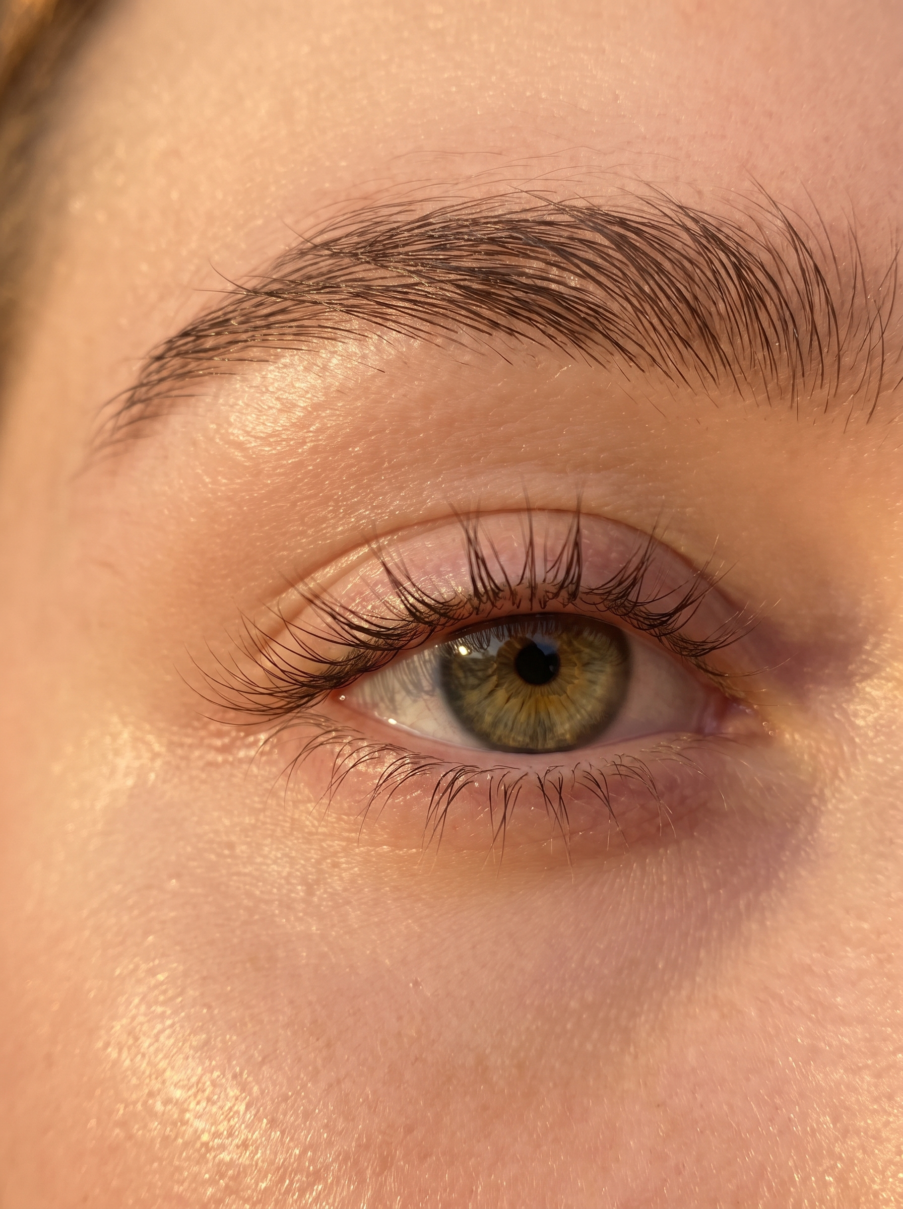 Eye Health