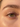 Eye Health